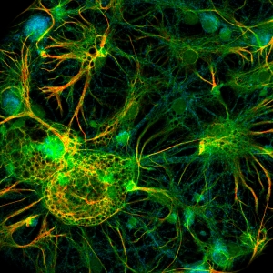 染色された神経細胞2