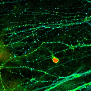 神経細胞(プレシナプスのBassoonとポストシナプスのHomerクラスター)2 